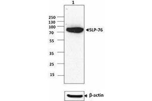 Western Blotting (WB) image for anti-Lymphocyte Cytosolic Protein 2 (SH2 Domain Containing Leukocyte Protein of 76kDa) (LCP2) (AA 216-434) antibody (ABIN2666114) (LCP2 antibody  (AA 216-434))