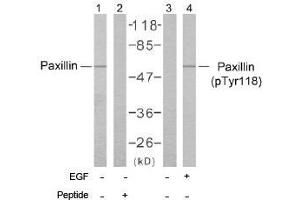 Image no. 2 for anti-Paxillin (PXN) (Tyr118) antibody (ABIN197279) (Paxillin antibody  (Tyr118))