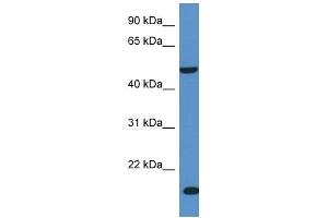 Western Blot showing INPP5K antibody used at a concentration of 1 ug/ml against Fetal Liver Lysate