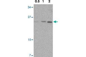 Western blot analysis of NKIRAS1 in Raw 264. (NKIRAS1 antibody  (C-Term))