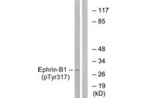Western blot analysis of extracts from mouse brain, using EFNB1 (Phospho-Tyr317) Antibody. (Ephrin B1 antibody  (pTyr317))