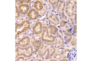 Immunohistochemistry of paraffin-embedded mouse kidney using CYP51A1 Antibody. (CYP51A1 antibody)