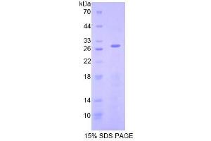 SDS-PAGE analysis of Human AIF Protein. (AIF Protein)