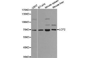Western blot analysis of extracts of various cell lines, using LCP2 antibody. (LCP2 antibody  (AA 284-533))
