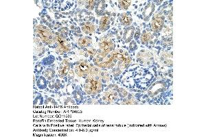 Human kidney (TAF6 antibody  (N-Term))