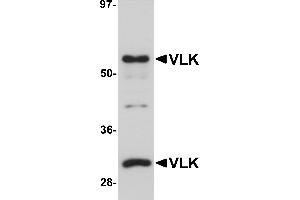 Western Blotting (WB) image for anti-Protein Kinase Domain Containing, Cytoplasmic Homolog (Mouse) (PKDCC) (Middle Region) antibody (ABIN1031161) (PKDCC antibody  (Middle Region))
