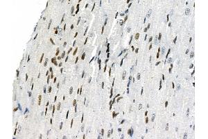 Phospho-Smad5 (Ser463/Ser465) Antibody at 1/100 staining Rat heart tissue by IHC-P.