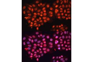 Immunofluorescence analysis of HeLa cells using  Polyclonal Antibody (ABIN3016382, ABIN3016383, ABIN3016384 and ABIN6219737) at dilution of 1:100 (40x lens). (ABCB8 antibody  (AA 469-718))