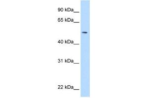 WB Suggested Anti-NEU1 Antibody Titration:  5. (NEU1 antibody  (Middle Region))