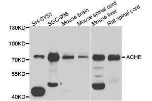 Western blot analysis of extracts of various cell lines, using ACHE antibody. (Acetylcholinesterase antibody  (AA 398-617))
