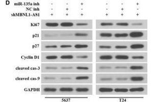 MBNL1-AS1 regulated the proliferation and apoptosis of BC cells via miR-135a/PHLPP2/FOXO1 axis. (Ki-67 antibody  (AA 700-800))
