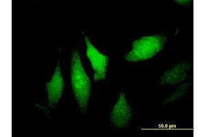 Immunofluorescence of purified MaxPab antibody to DNALI1 on HeLa cell.