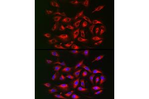Immunofluorescence analysis of U2OS cells using IRS2 Rabbit pAb (ABIN6128094, ABIN6142544, ABIN6142545 and ABIN6223949) at dilution of 1:25 (40x lens). (IRS2 antibody  (AA 510-650))
