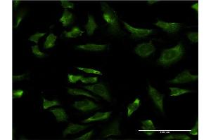 Immunofluorescence of monoclonal antibody to LOC402176 on HeLa cell. (RPL21P44 antibody  (AA 1-136))