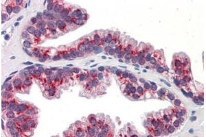 Human Prostate: Formalin-Fixed, Paraffin-Embedded (FFPE) (KLF4 antibody  (AA 401-450))