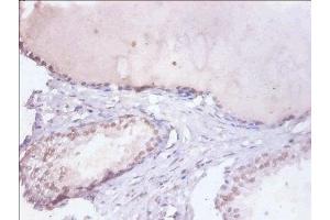 Immunohistochemistry of paraffin-embedded human prostate tissue using ABIN7155104 at dilution of 1:100 (HNRNPD/AUF1 antibody  (AA 18-355))