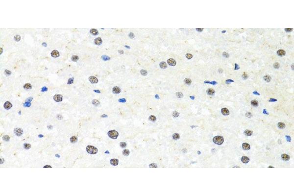 PPP4C antibody