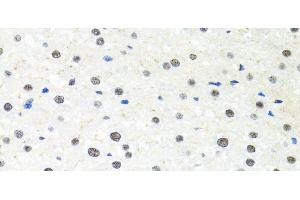 Immunohistochemistry of paraffin-embedded Rat liver using PPP4C Polyclonal Antibody at dilution of 1:100 (40x lens).