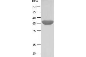 PON1 Protein (AA 1-355) (His tag)