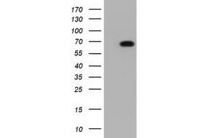 HEK293T cells were transfected with the pCMV6-ENTRY control (Left lane) or pCMV6-ENTRY AK5 (Right lane) cDNA for 48 hrs and lysed. (Adenylate Kinase 5 antibody)