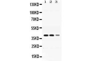 Western blot analysis of ADH4 expression in rat liver extract ( Lane 1), mouse liver extract ( Lane 2) and HEPG2 whole cell lysates ( Lane 3). (ADH4 antibody  (AA 218-380))