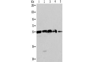 Western Blotting (WB) image for anti-Nicotinamide phosphoribosyltransferase (NAMPT) antibody (ABIN2428901)
