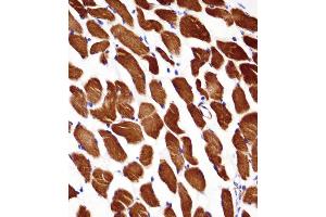 ACTA1/alpha -actin Antibody immunohistochemistry analysis in formalin fixed and paraffin embedded human skeletal muscle followed by peroxidase conjugation of the secondary antibody and DAB staining.