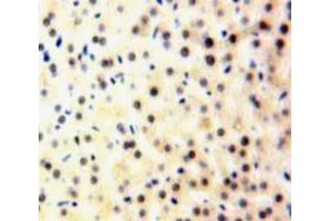 Used in DAB staining on fromalin fixed paraffin-embedded Liver tissue (A2BP1 antibody  (AA 149-399))