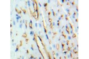 Used in DAB staining on fromalin fixed paraffin-embedded Heart tissue (BNP antibody  (AA 77-121))