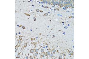 Immunohistochemistry of paraffin-embedded mouse brain using FDFT1 antibody (ABIN5973667) at dilution of 1/100 (40x lens). (FDFT1 antibody)