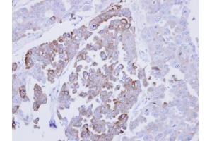 IHC-P Image Immunohistochemical analysis of paraffin-embedded OVCAR3 xenograft, using ERP29, antibody at 1:500 dilution. (ERP29 antibody)