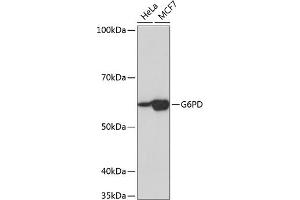 Western blot analysis of extracts of various cell lines, using G6PD Rabbit mAb (ABIN7267402) at 1:1000 dilution. (Glucose-6-Phosphate Dehydrogenase antibody)