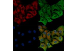 ABIN6258423 and ABIN6276238 staining Hela cells by IF/ICC.