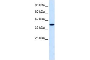 Western Blotting (WB) image for anti-Zinc Finger Protein 75 (ZNF75) antibody (ABIN2461224) (ZNF75 antibody)