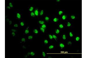 Immunofluorescence of monoclonal antibody to STAG2 on HeLa cell. (STAG2 antibody  (AA 1130-1231))