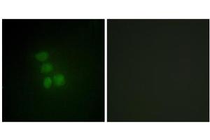 Immunofluorescence analysis of HepG2 cells, using hnRNP G antibody.
