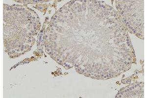 ABIN6273477 at 1/100 staining RAT testis tissue by IHC-P. (CYLC1 antibody)