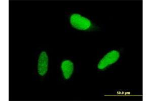 Immunofluorescence of purified MaxPab antibody to USP18 on HeLa cell. (USP18 antibody  (AA 1-372))