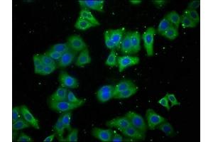 Immunofluorescence staining of HepG2 cells with ABIN7158034 at 1:100, counter-stained with DAPI. (LARS antibody  (AA 614-892))