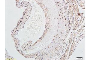 Immunohistochemistry (Paraffin-embedded Sections) (IHC (p)) image for anti-Oxidized Low Density Lipoprotein (Lectin-Like) Receptor 1 (OLR1) (AA 201-273) antibody (ABIN676988)