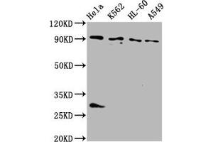 Western Blot Positive WB detected in: Hela whole cell lysate, K562 whole cell lysate, HL60 whole cell lysate, A549 whole cell lysate All lanes: BICD2 antibody at 4 μg/mL Secondary Goat polyclonal to rabbit IgG at 1/50000 dilution Predicted band size: 94, 97 kDa Observed band size: 94 kDa