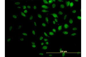 Immunofluorescence of monoclonal antibody to TRIM33 on HeLa cell. (TRIM33 antibody  (AA 1006-1105))