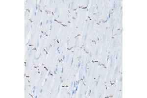 Immunohistochemistry of paraffin-embedded rat heart using N-Cadherin Rabbit pAb (ABIN3017242, ABIN3017243, ABIN3017244 and ABIN6220011) at dilution of 1:50 (40x lens). (N-Cadherin antibody  (AA 750-850))