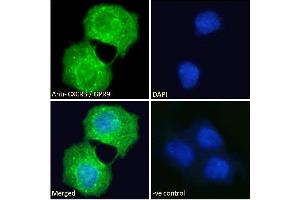 ABIN334381 Immunofluorescence analysis of paraformaldehyde fixed A431 cells, permeabilized with 0. (CXCR3 antibody  (C-Term))