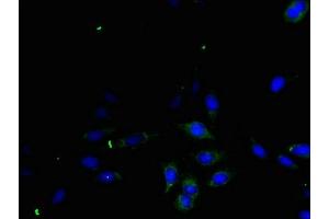 Immunofluorescent analysis of Hela cells using ABIN7166593 at dilution of 1:100 and Alexa Fluor 488-congugated AffiniPure Goat Anti-Rabbit IgG(H+L) (TGFA antibody  (AA 40-89))
