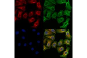 ABIN6255025 and ABIN6266462 staining Hela cells(heat shock treatment) by IF/ICC.