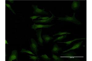 Immunofluorescence of monoclonal antibody to MAPKAPK2 on HeLa cell. (MAPKAP Kinase 2 antibody  (AA 266-352))