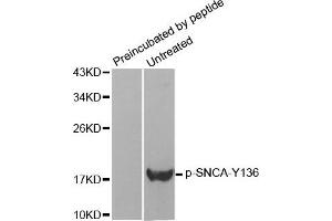Western Blotting (WB) image for anti-Synuclein, alpha (SNCA) (pTyr136) antibody (ABIN1870623) (SNCA antibody  (pTyr136))