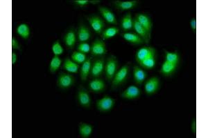 Immunofluorescence staining of A549 cells with ABIN7169333 at 1:66, counter-stained with DAPI. (SERPINB12 antibody  (AA 1-300))