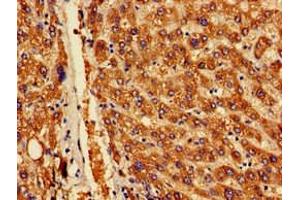 Immunohistochemistry of paraffin-embedded human liver tissue using ABIN7142170 at dilution of 1:100 (OAS1 antibody  (AA 296-395))